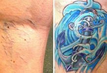 Visszér tetoválás